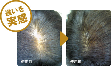 気になる薄毛にも育毛効果